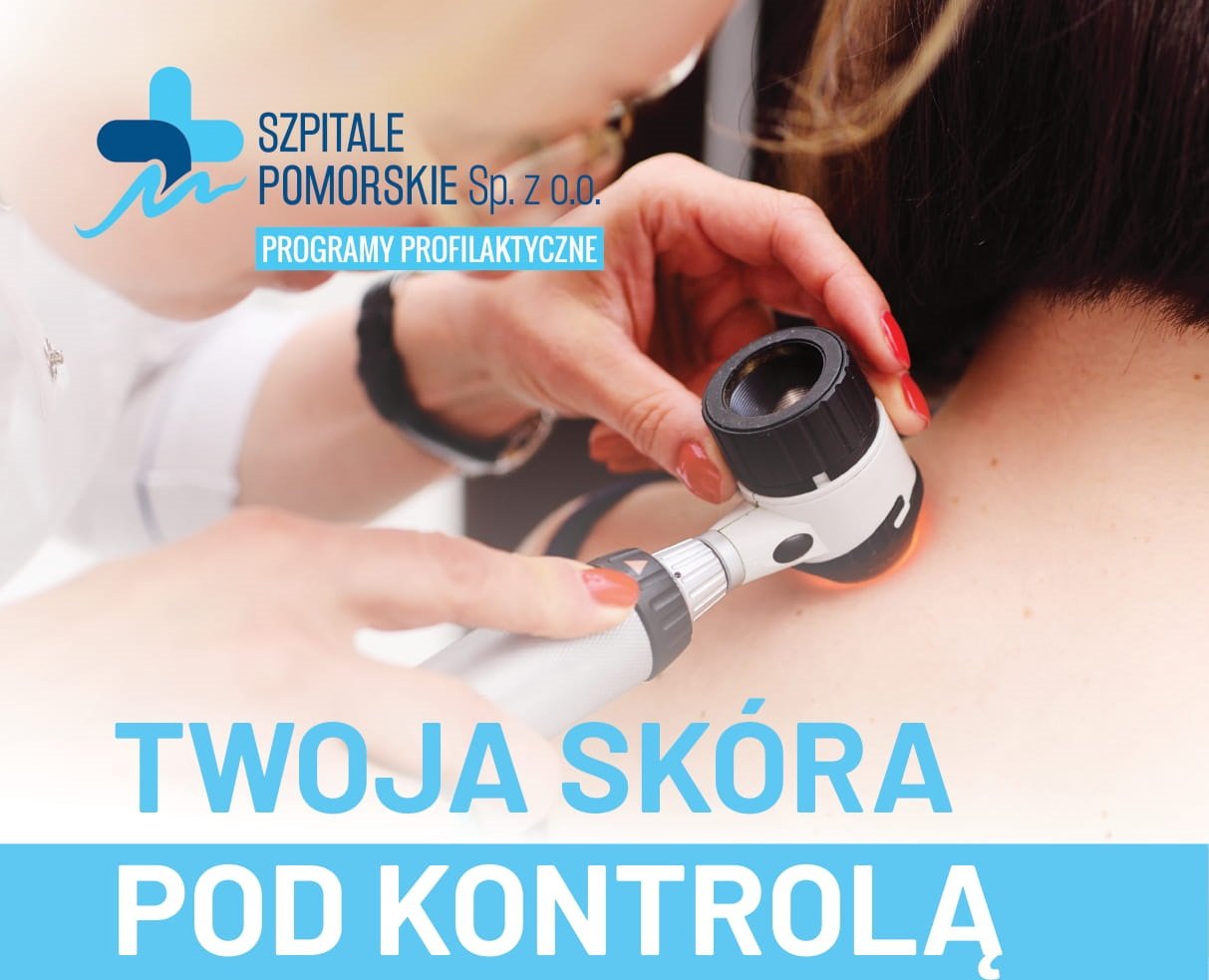 Program prowadzony przez Szpitale Pomorskie pozwala mieć znamiona pod kontrolą - przebadać je oraz dowiedzieć się, jak rozsądnie korzystać z uroków lata bez ryzyka dla zdrowia, mat. Szpitale Pomorskie