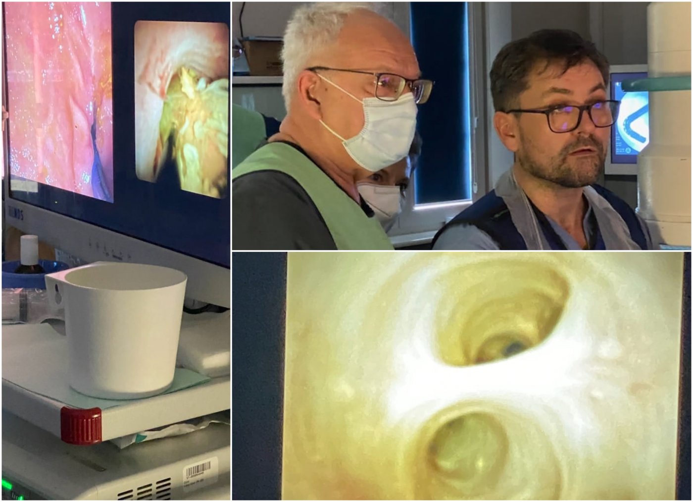 Kolaż trzech zdjęć. Z lewej zdjęcie monitora na sali zabiegowej z fragmentem dróg żółciowych, u góry dr Cezary Adamiec i dr n.med. Andrzej Banasiuk, na dole wyświetlacz sali zabiegowej z drogami żółciowymi pacjenta.