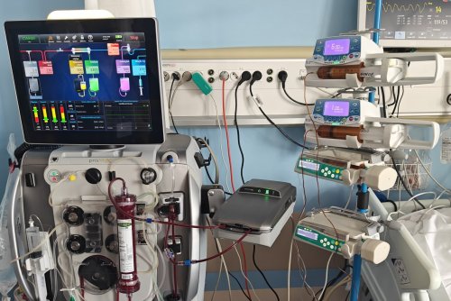 Urządzenie do dializy CRRT (fot. materiały prasowe Szpitali Pomorskich)