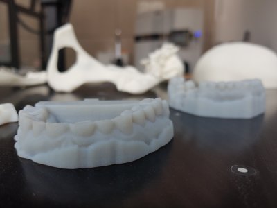 Modele protez wykonane technologią druku 3D // fot. PPNT Gdynia