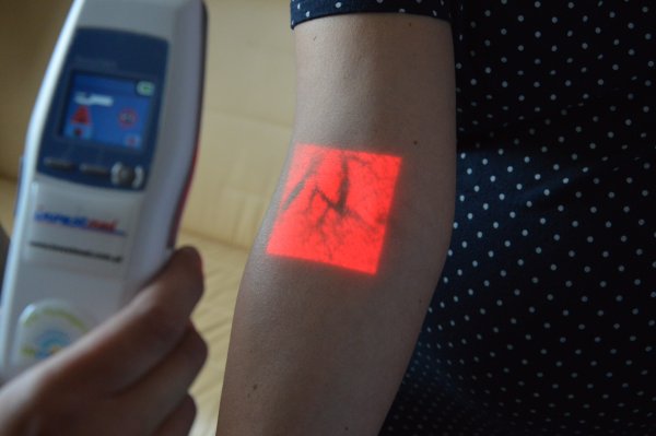 Skaner żylny dla redłowskiego szpitala