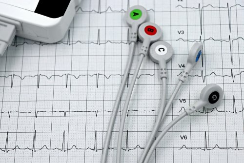 Papierowy wydruk EKG, elektrody, urządzenie do pomiaru