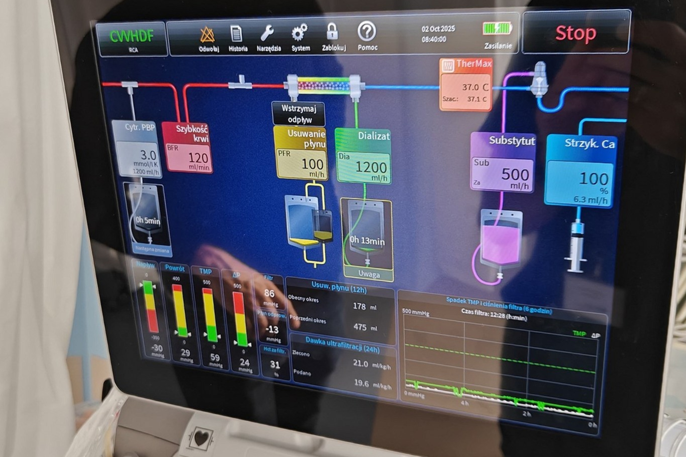 Urządzenie do dializy CRRT (fot. materiały prasowe Szpitali Pomorskich)
