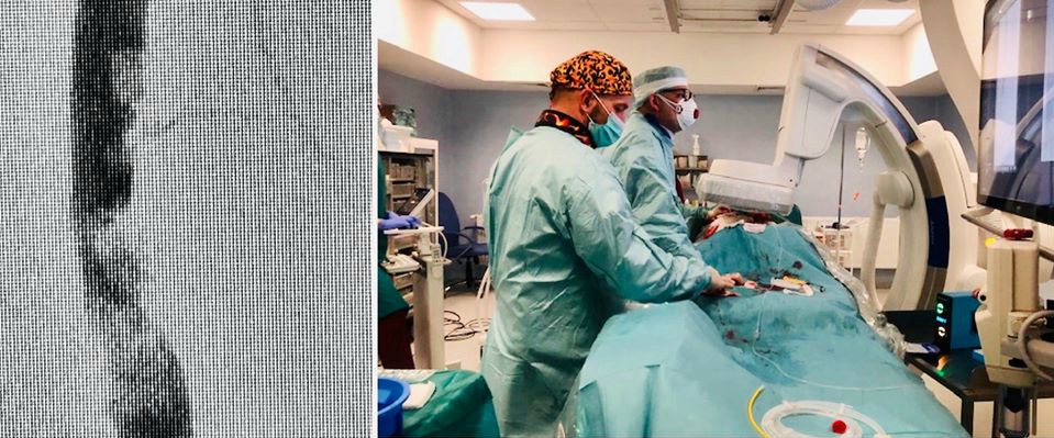 Zesp&oacute;ł dr Ryszarda Zająca w czasie zabiegu, fot. Szpitale Pomorskie