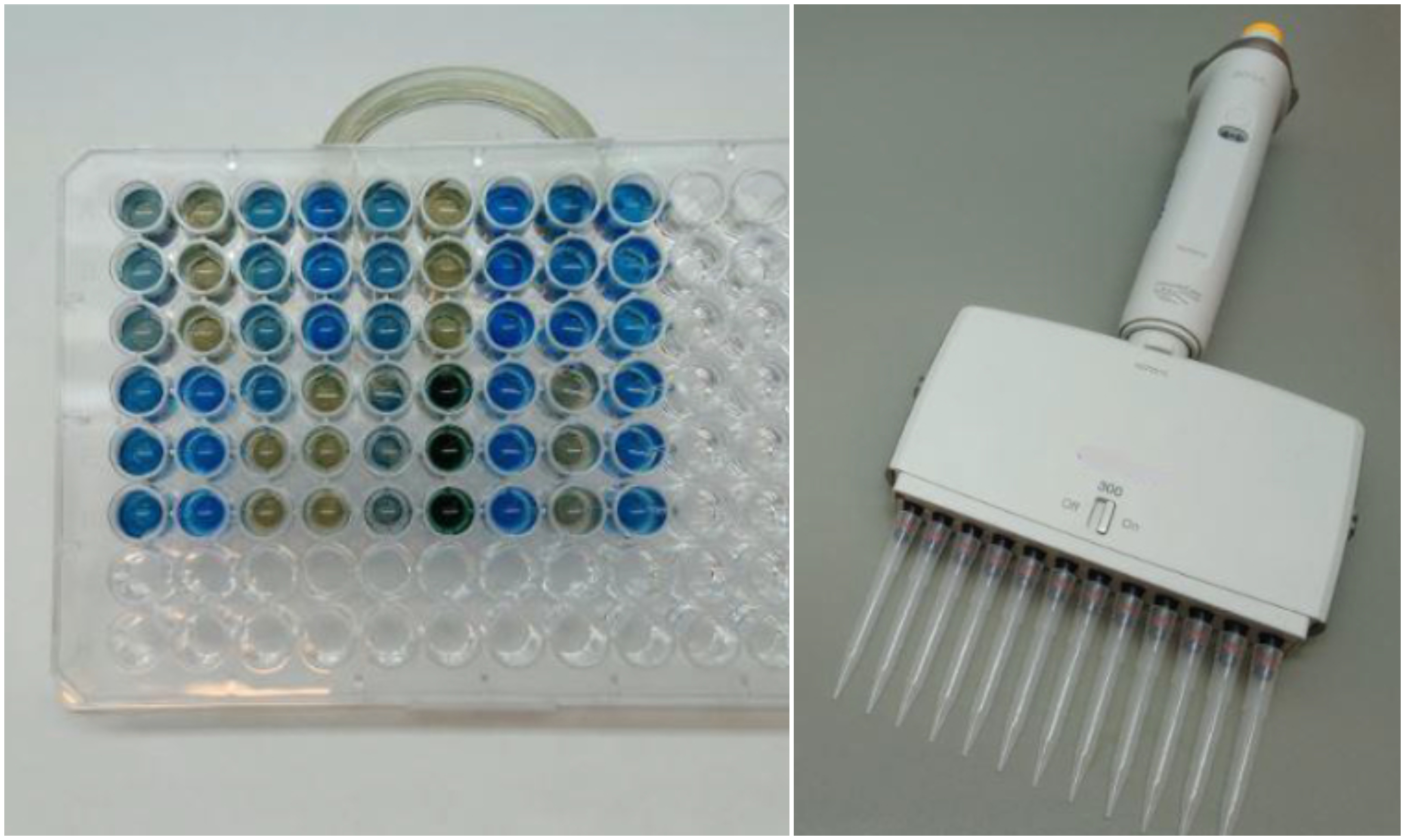 Tak wygląda patent naukowc&oacute;w z UG, kt&oacute;ry przetestowano na gdyńskiej urologii, fot. archwium Uniwersytetu Gdańskiego